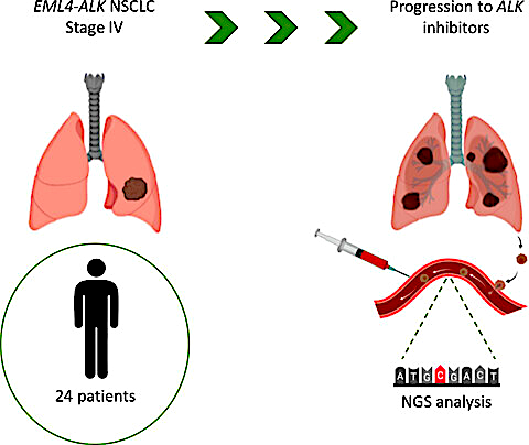 NGS ALK publication